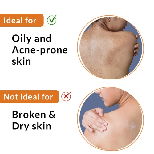 Fixderma Salyzap Body Spray For Acne on Back, Shoulders, Neck & Chest - 50ml