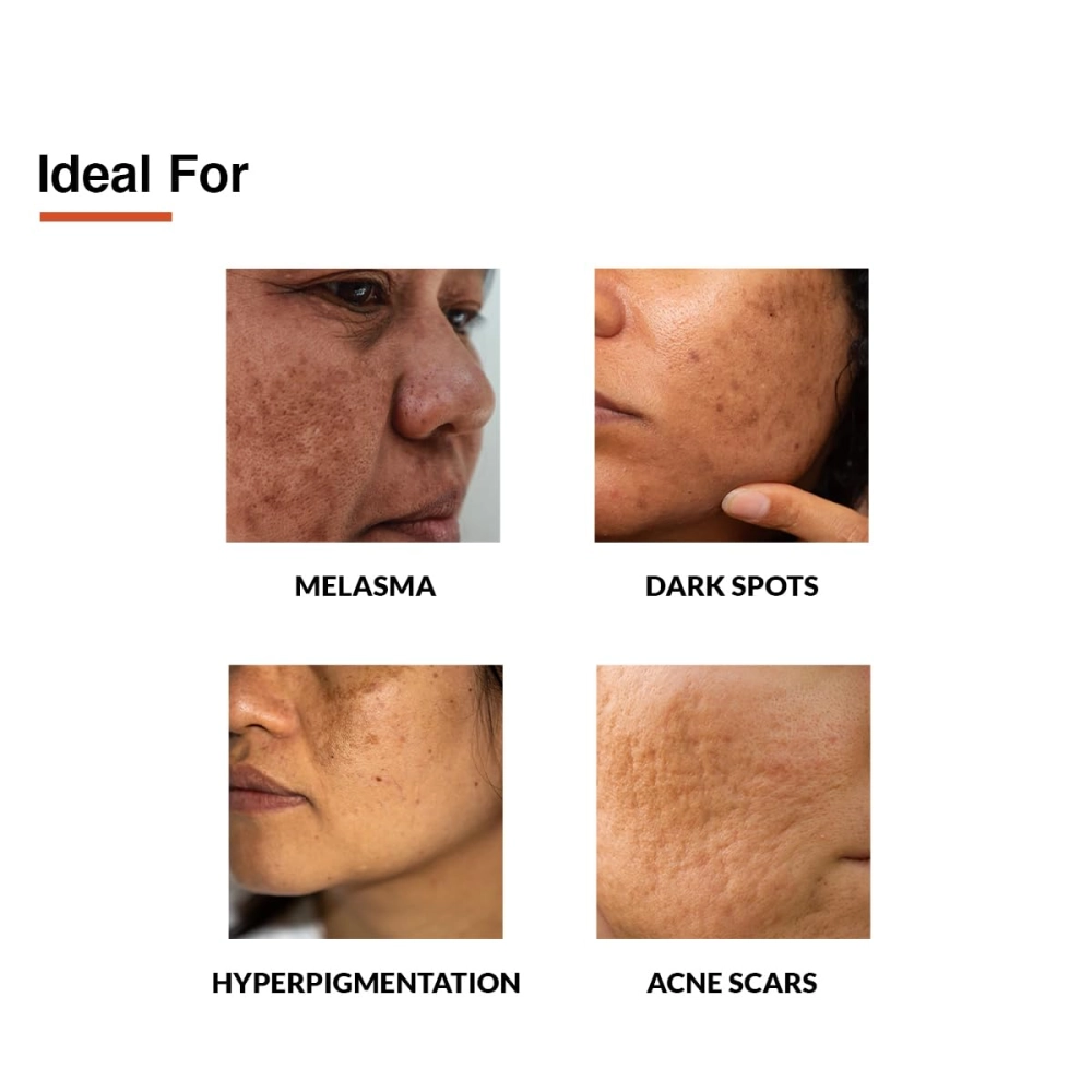 Fixderma Skarfix-TX Cream - 15 gm