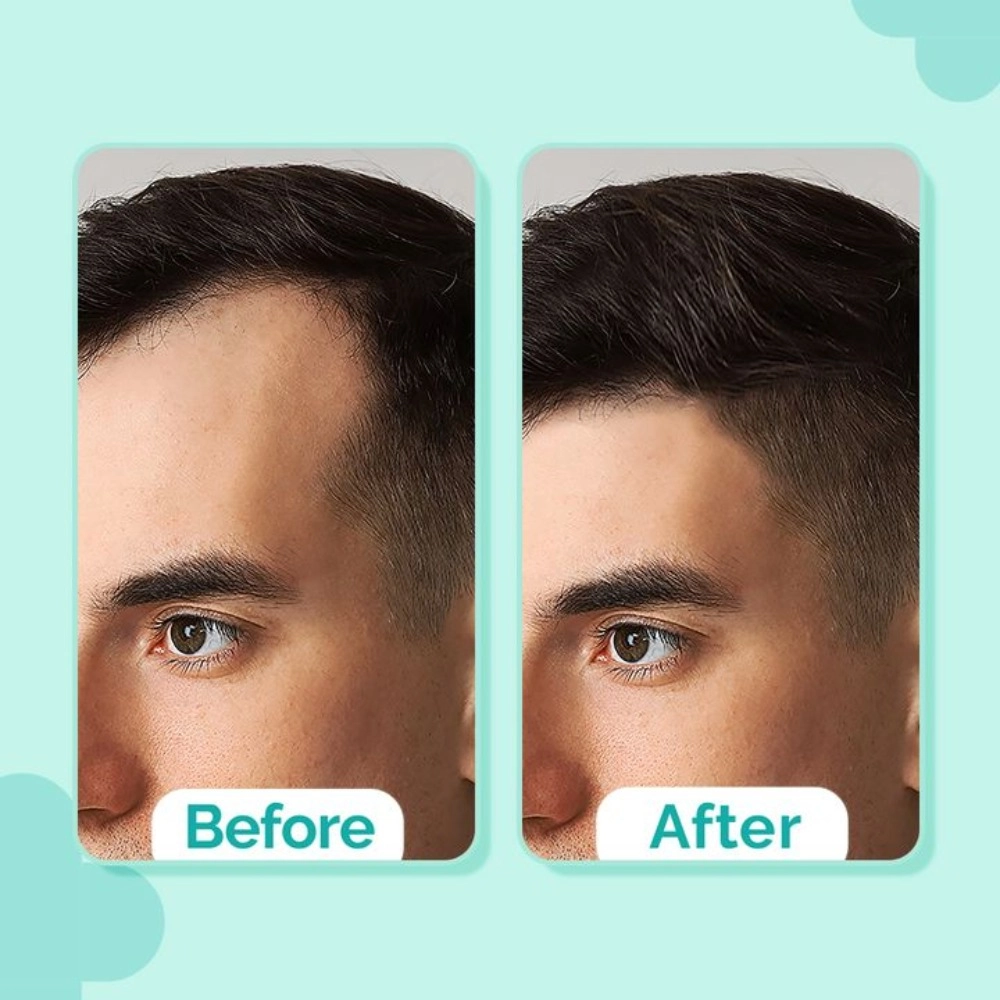 The Derma Co. 20% Actives Peptide-Stem Cell Hair Growth Serum With Foligen Analupe & Anagain for Hair Growth 30ml